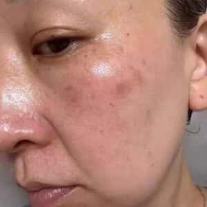 KEM BẠCH TUYẾT DƯỠNG TRẮNG , ĐỀU MÀU, KIỀM DẦU, TÁI TẠO DA - BẢN NẮP TRẮNG - Ảnh 3