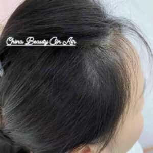 VIÊN UỐNG MỌC TÓC BIOTIN - TRỊ HÓI, TRỊ RỤNG, PHỤC HỒI HƯ TỔN NEWZEALAND - Ảnh 8