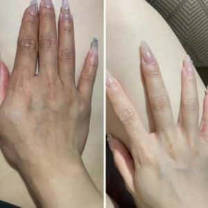 OBLUE - LIỆU PHÁP TRUYỀN TRẮNG, GIẢM NÁM BẰNG ĐƯỜNG UỐNG CAO CẤP - Ảnh 10
