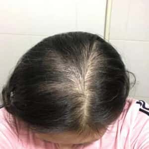 VIÊN UỐNG MỌC TÓC BIOTIN - TRỊ HÓI, TRỊ RỤNG, PHỤC HỒI HƯ TỔN NEWZEALAND - Ảnh 3