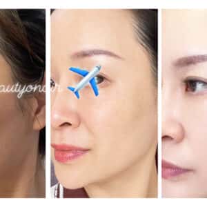 OBLUE - LIỆU PHÁP TRUYỀN TRẮNG, GIẢM NÁM BẰNG ĐƯỜNG UỐNG CAO CẤP - Ảnh 4