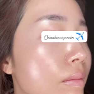 OBLUE - LIỆU PHÁP TRUYỀN TRẮNG, GIẢM NÁM BẰNG ĐƯỜNG UỐNG CAO CẤP - Ảnh 5
