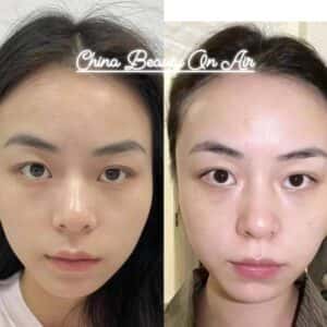 KEM DƯỠNG VITAMIN C 10% CAO CẤP GIÚP SÁNG ĐỀU MÀU - Ảnh 5