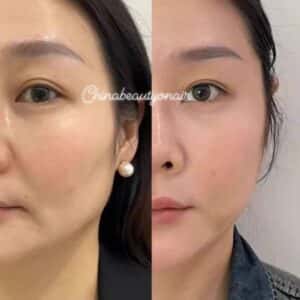 EGT2100 -TRƯỜNG SINH, ĐẢO CHIỀU LÃO HÓA, TRẺ RA CHỤC TUỔI, TÁI TẠO TẾ BÀO MỚI - Ảnh 7