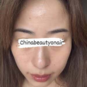 KEM NÁM VÀ TÁI TẠO DA CĂNG BÓNG, TRẮNG HỒNG ORGINESE - BẢN MỚI - Ảnh 7