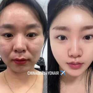 EGT2100 -TRƯỜNG SINH, ĐẢO CHIỀU LÃO HÓA, TRẺ RA CHỤC TUỔI, TÁI TẠO TẾ BÀO MỚI - Ảnh 5