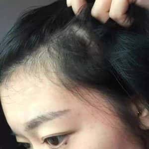 SERUM MỌC TÓC, TRỊ HÓI - HIỆU QUẢ GẤP 3 LẦN CÁC DÒNG THƯỜNG - BS. BAWANG - Ảnh 5