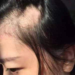 SERUM MỌC TÓC, TRỊ HÓI - HIỆU QUẢ GẤP 3 LẦN CÁC DÒNG THƯỜNG - BS. BAWANG - Ảnh 4