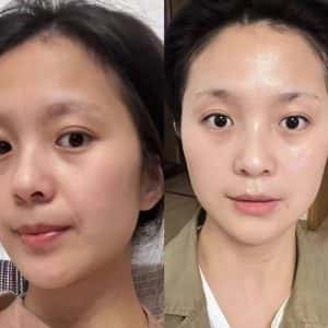 HUYẾT THANH RETINOL 2.0 - FROM SINGAPORE, căng bóng và xóa nhăn tức thì - Ảnh 3