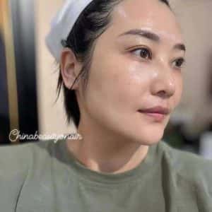 HUYẾT THANH RETINOL 2.0 - FROM SINGAPORE, căng bóng và xóa nhăn tức thì - Ảnh 4