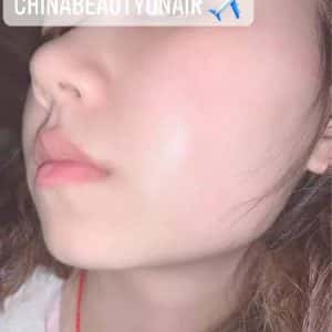 VIÊN UỐNG ĐÀO THẢI NÁM NỘI TIẾT - NHUẬN KHÍ - DƯỠNG HỒNG HÀO TỪ BÊN TRONG - Ảnh 4